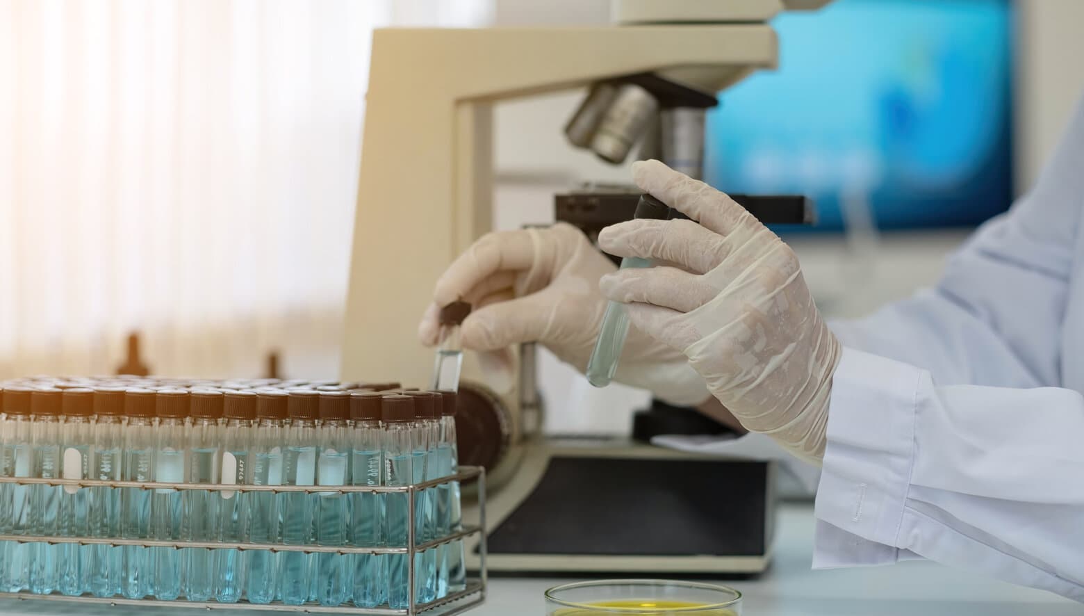 Laboratory technician handling water sample tubes beside a microscope during Legionella testing